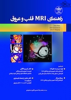 راهنمای MRI قلب و عروق